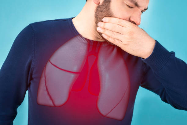 BRONŞİT İÇİN ŞİFA